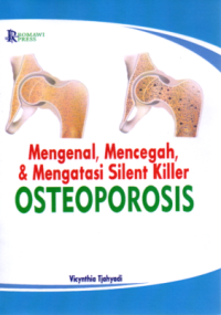 Mengenal, Mencegah, & Mengatasi Silent Killer Osteoporosis
